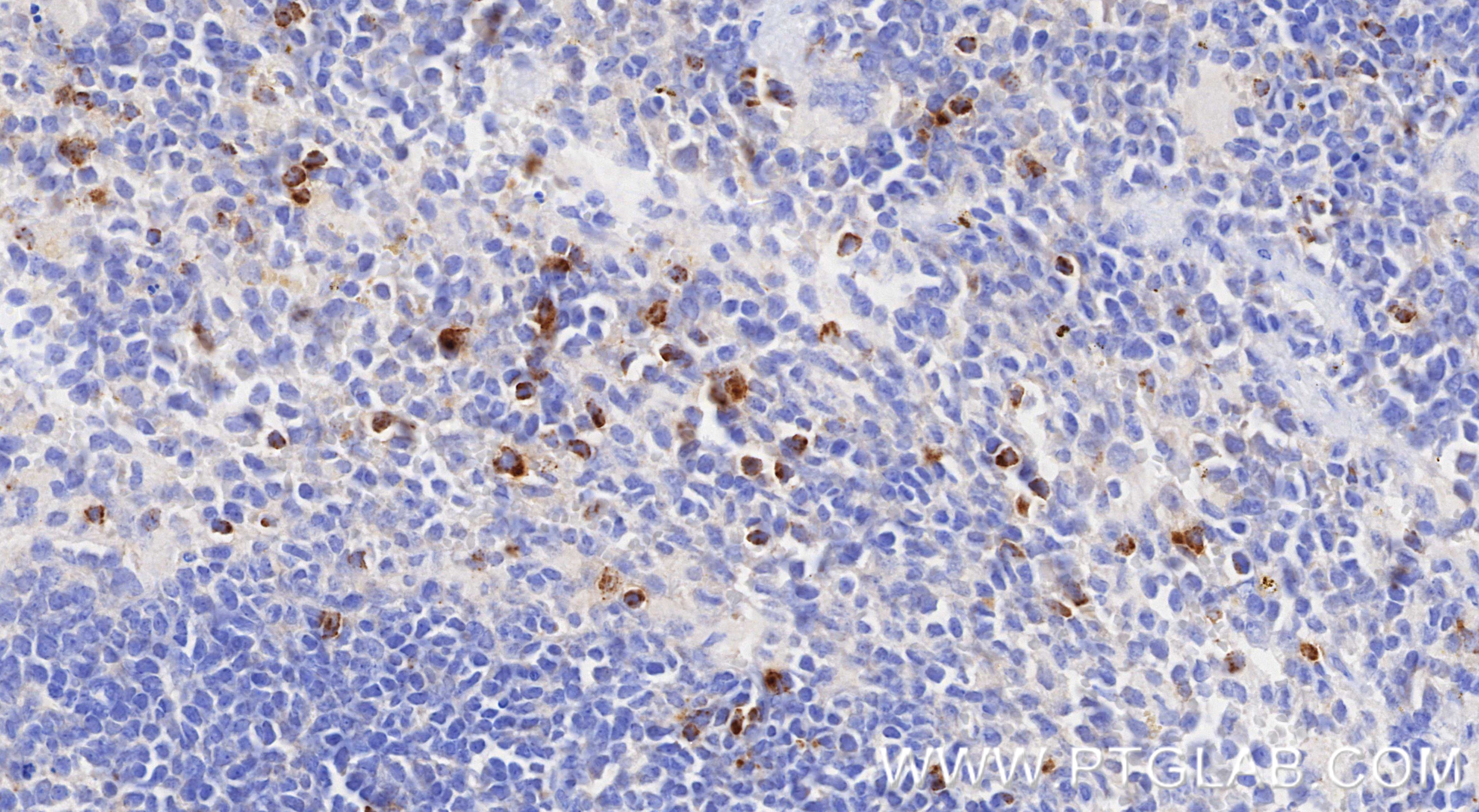 IHC staining of mouse spleen using 87060-4-RR IHC staining of mouse spleen using 87060-4-RR