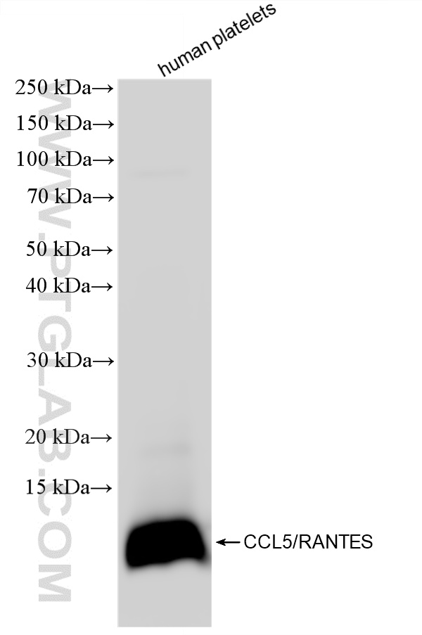 WB analysis of human peripheral blood platelets using 88173-1-RR WB analysis of human peripheral blood platelets using 88173-1-RR