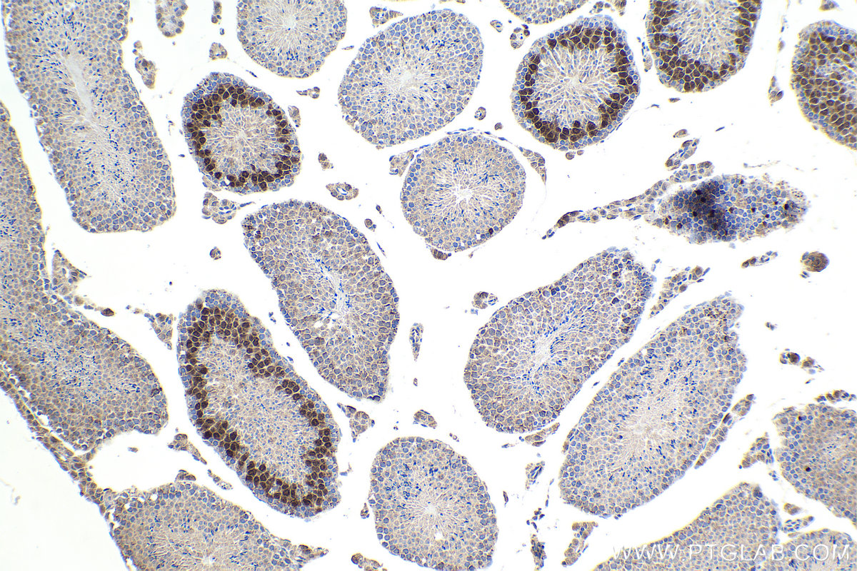 IHC staining of mouse testis using 13295-1-AP