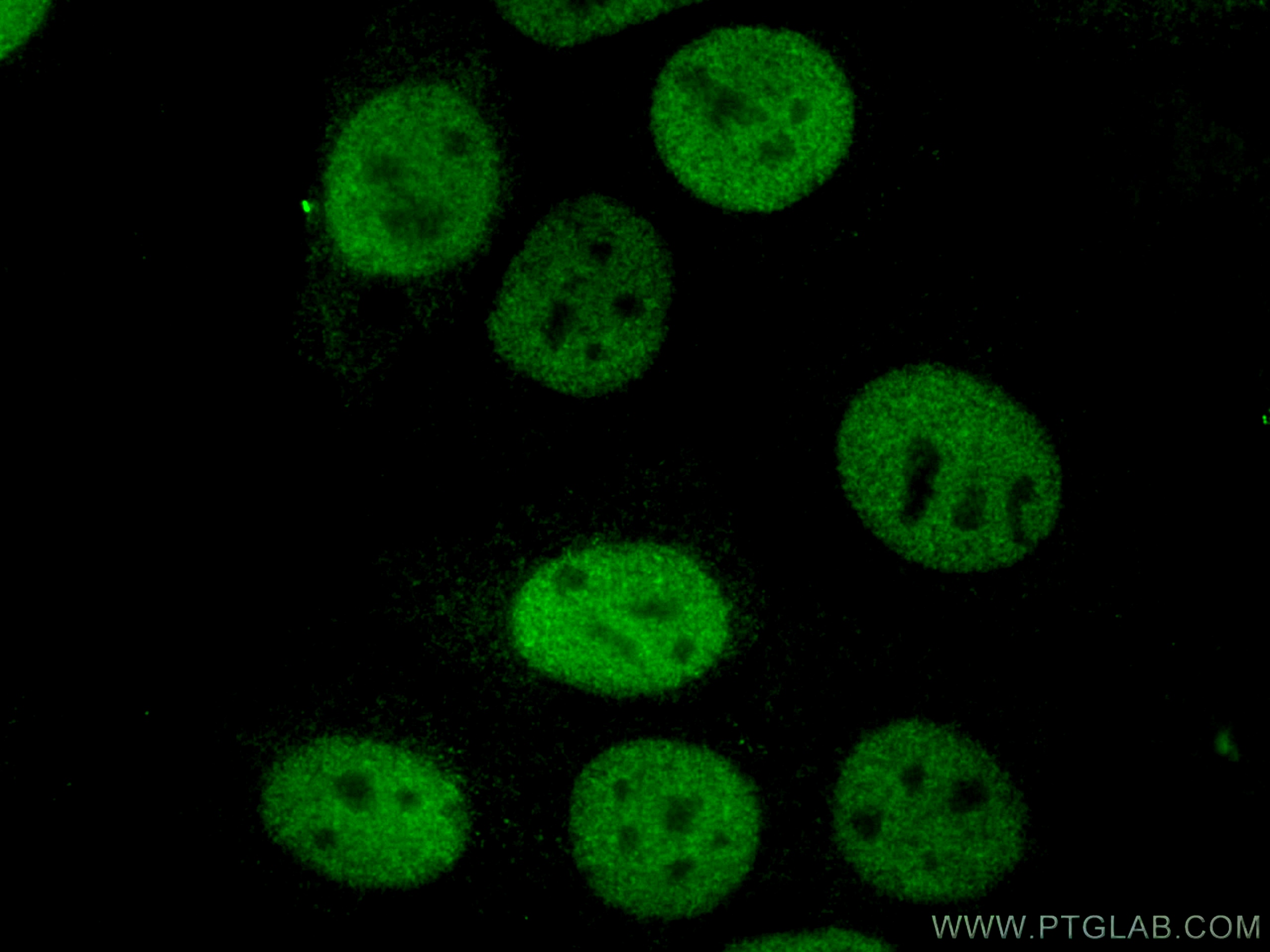 IF Staining of MCF-7 using 18202-1-AP
