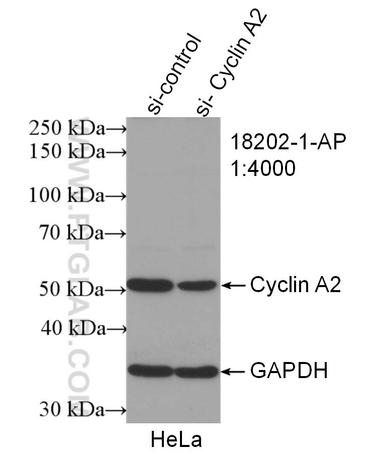 WB analysis of HeLa using 18202-1-AP