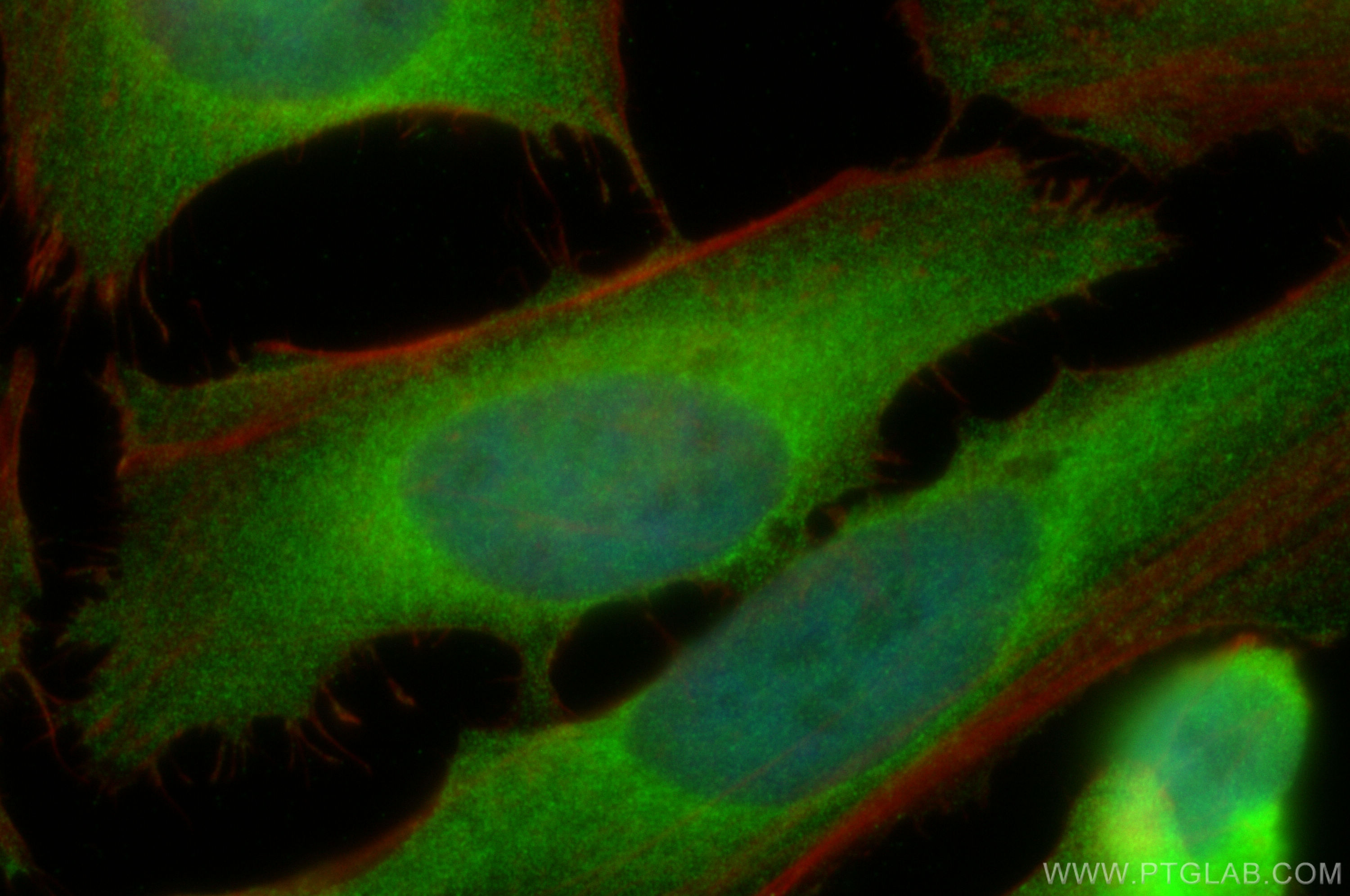 IF Staining of HeLa using 55004-1-AP