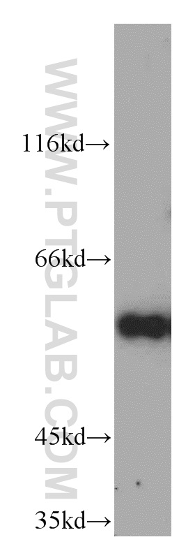 Cyclin B1 Polyclonal antibody