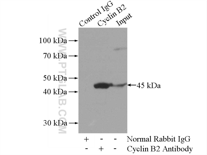 IP experiment of A431 using 21644-1-AP