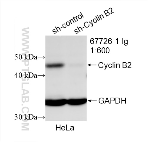 WB analysis of HeLa using 67726-1-Ig