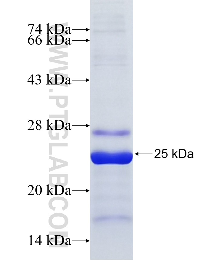 CCNB3 fusion protein Ag36851 SDS-PAGE CCNB3 fusion protein Ag36851 SDS-PAGE