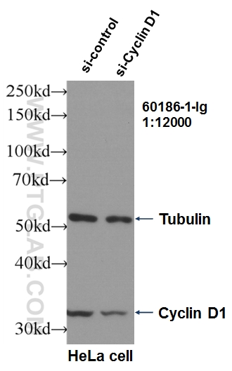 WB analysis of HeLa using 60186-1-Ig