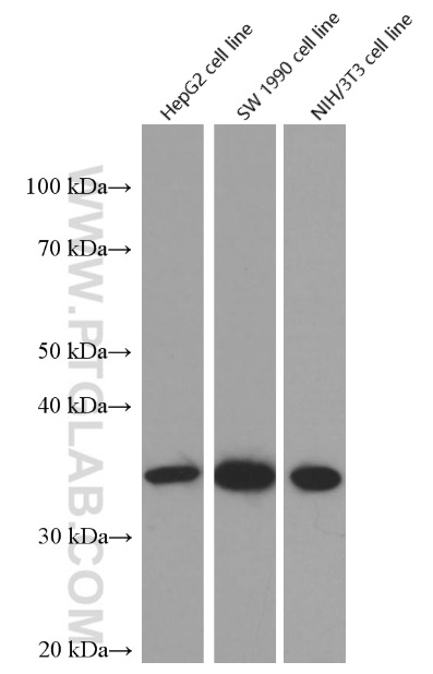 Cyclin D1 Monoclonal antibody