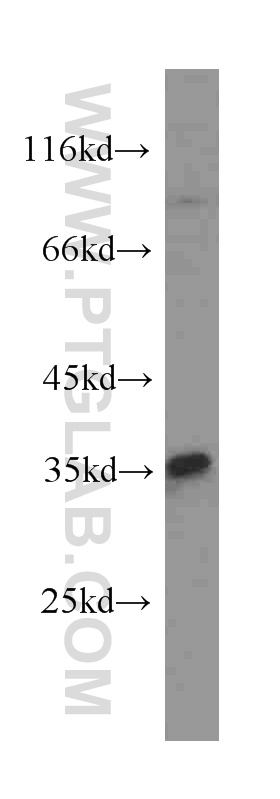 Cyclin D1 Monoclonal antibody