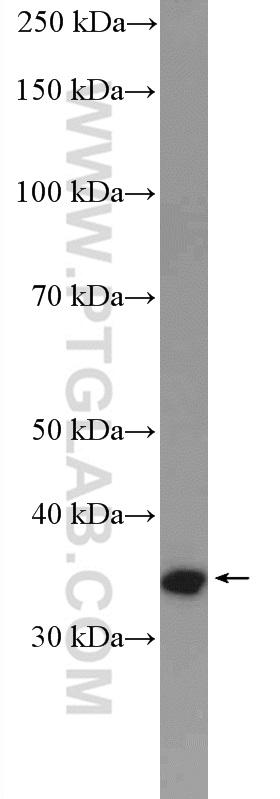 Cyclin D2 Polyclonal antibody