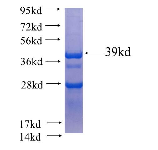 CCND2 fusion protein Ag25190 SDS-PAGE
