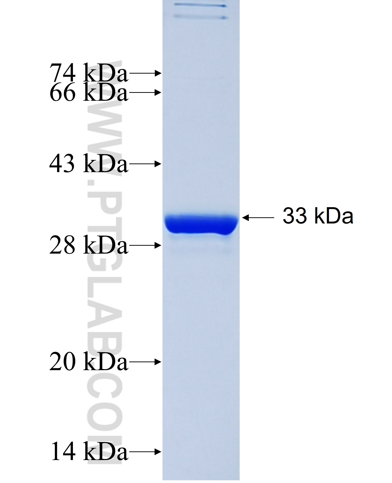 CCND2 fusion protein Ag29711 SDS-PAGE CCND2 fusion protein Ag29711 SDS-PAGE