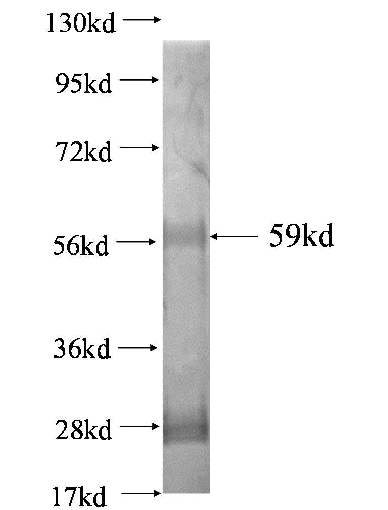 CCND2 fusion protein Ag0888 SDS-PAGE CCND2 fusion protein Ag0888 SDS-PAGE