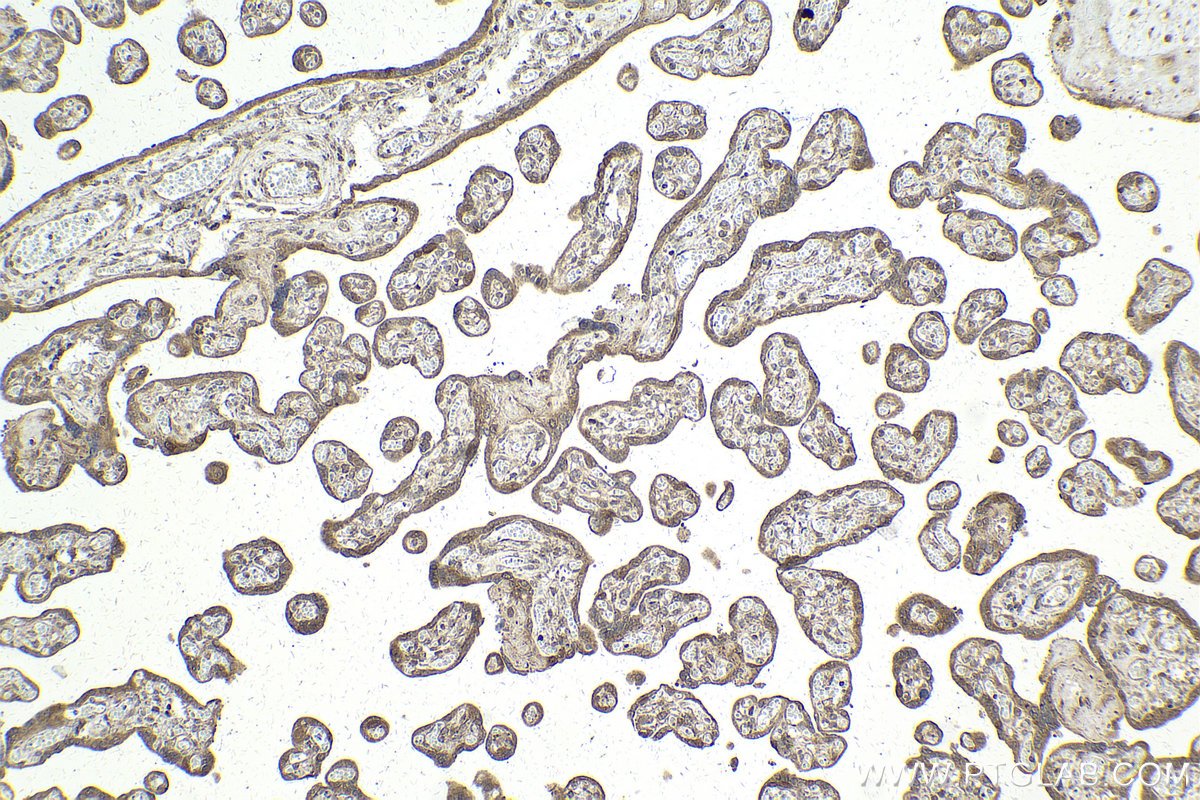 IHC staining of human placenta using 12363-1-AP IHC staining of human placenta using 12363-1-AP