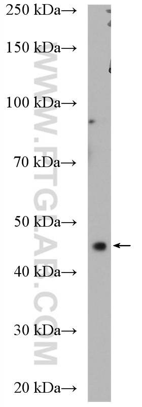 WB analysis of HeLa using 12363-1-AP