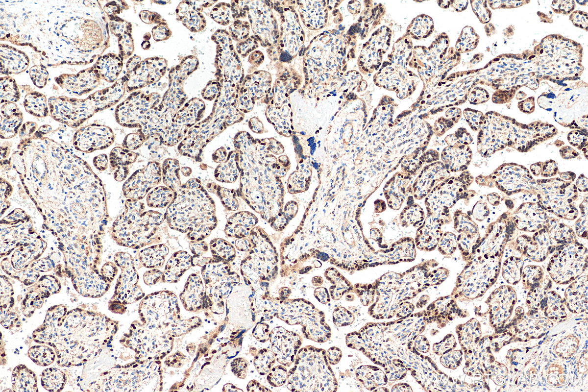 IHC staining of human placenta using 11554-1-AP