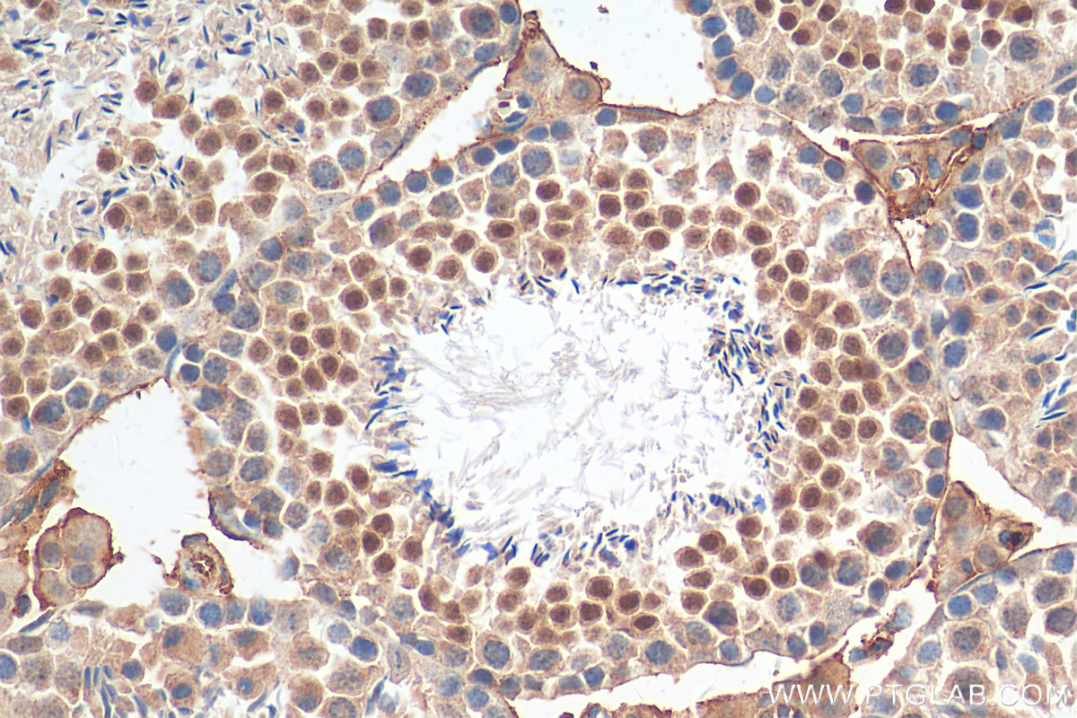 IHC staining of mouse testis using 11554-1-AP