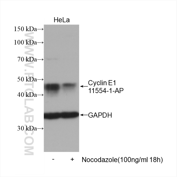 WB analysis of HeLa using 11554-1-AP