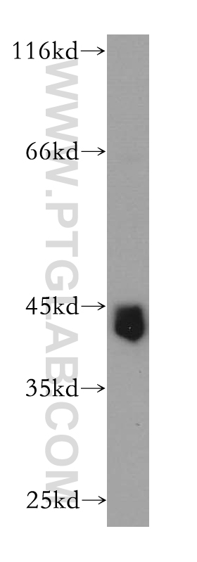 Cyclin E2 Polyclonal antibody