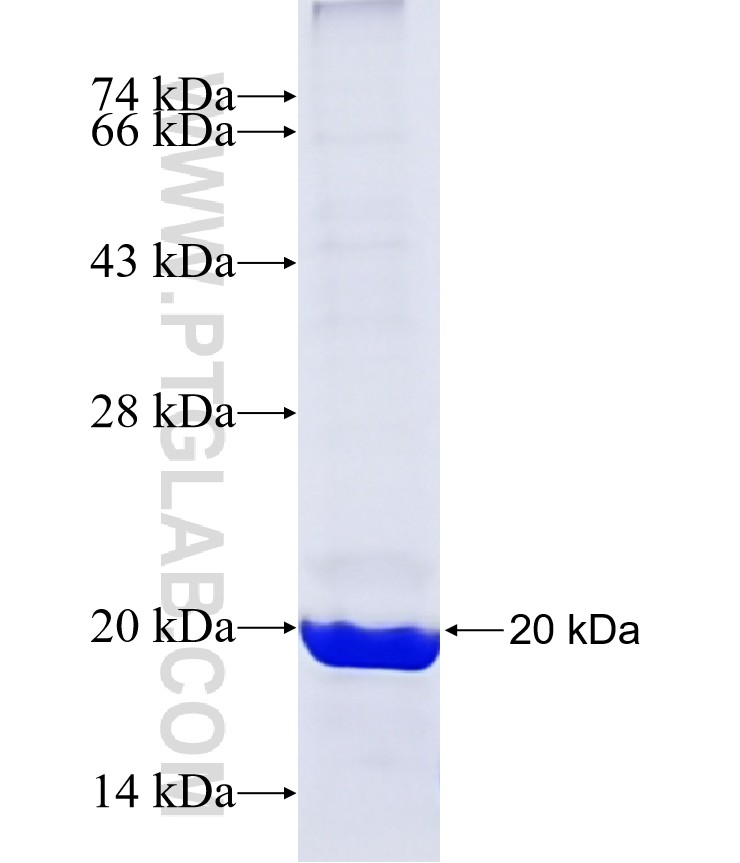 CCNE2 fusion protein Ag29625 SDS-PAGE CCNE2 fusion protein Ag29625 SDS-PAGE