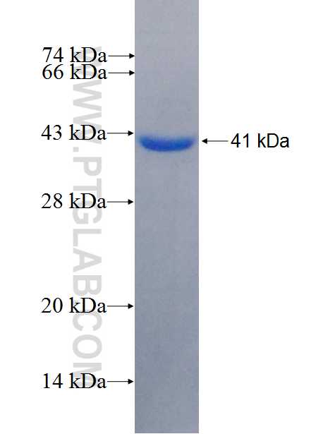 CCNG2 fusion protein Ag26627 SDS-PAGE CCNG2 fusion protein Ag26627 SDS-PAGE