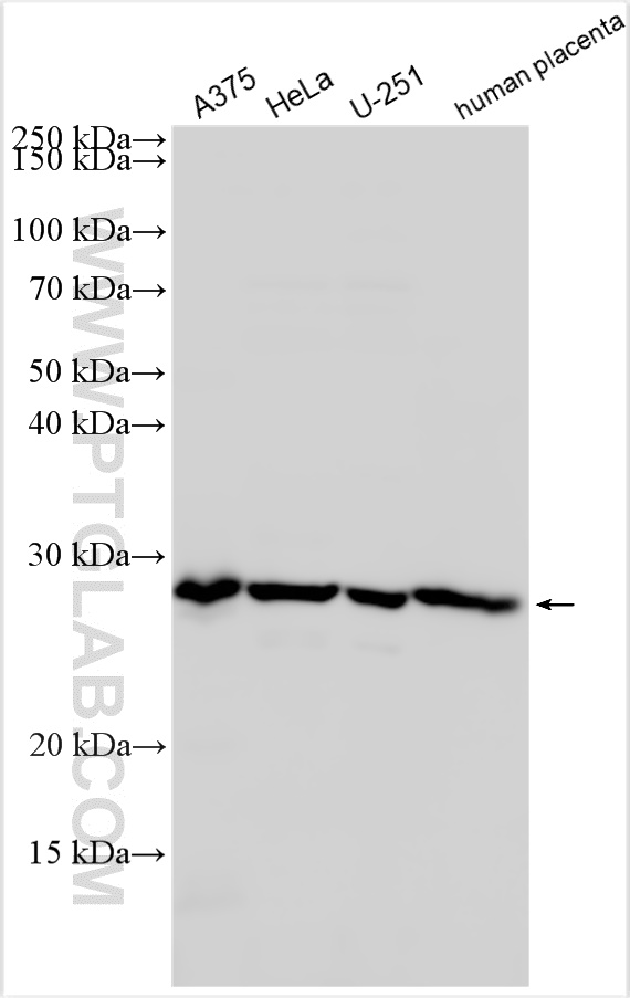 WB analysis using 11212-1-AP