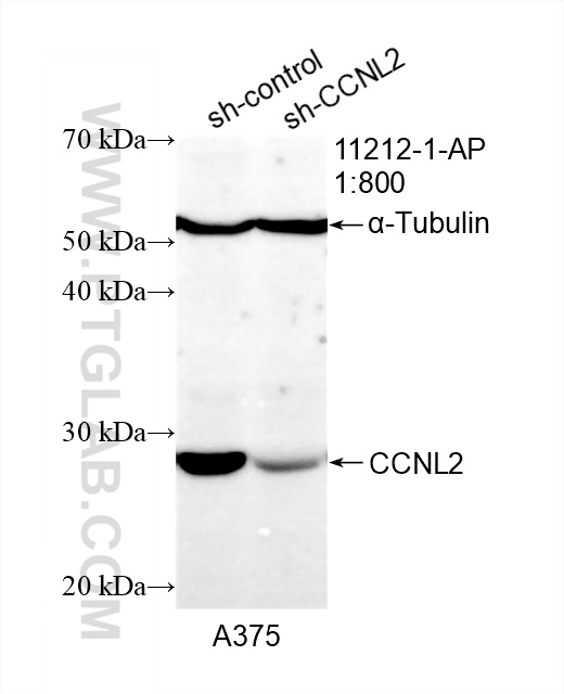 WB analysis of A375 using 11212-1-AP