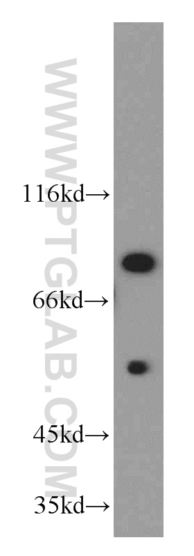 Cyclin T1 Polyclonal antibody