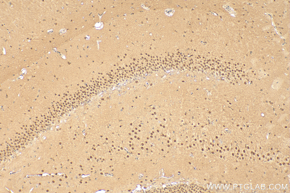 IHC staining of rat brain using 21860-1-AP