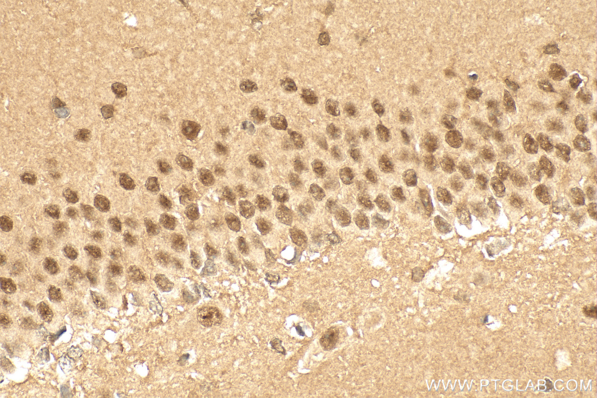 IHC staining of rat brain using 21860-1-AP
