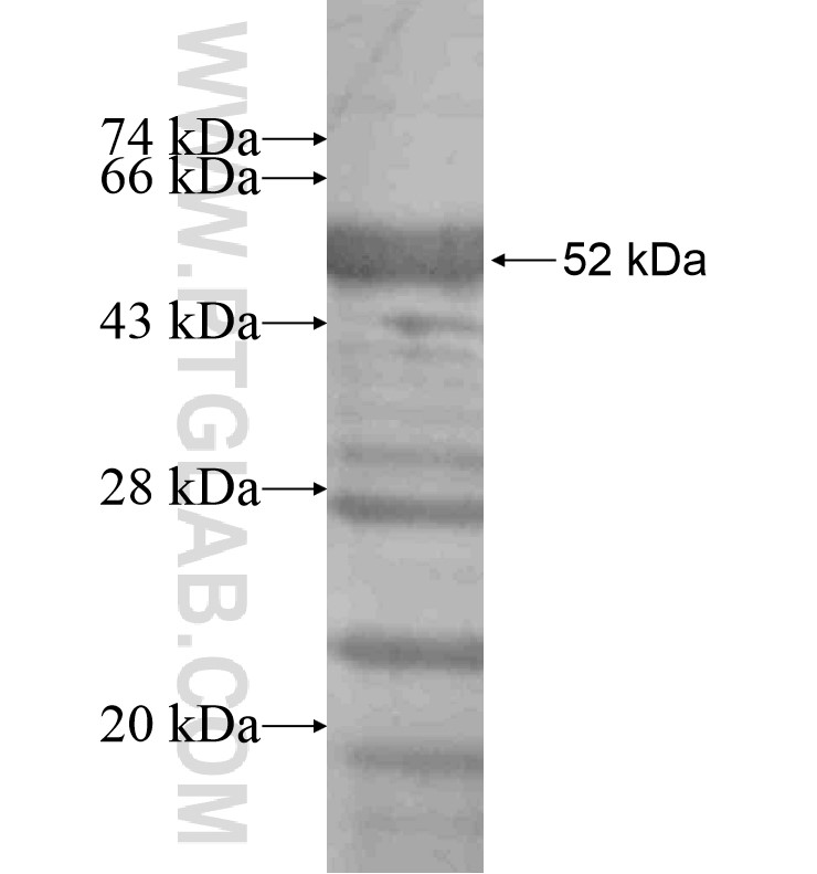 CCNT2 fusion protein Ag16519 SDS-PAGE CCNT2 fusion protein Ag16519 SDS-PAGE