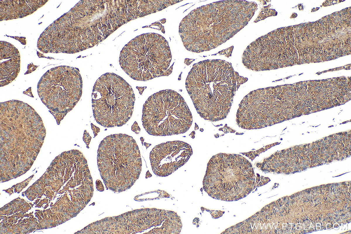 IHC staining of mouse testis using 18042-1-AP