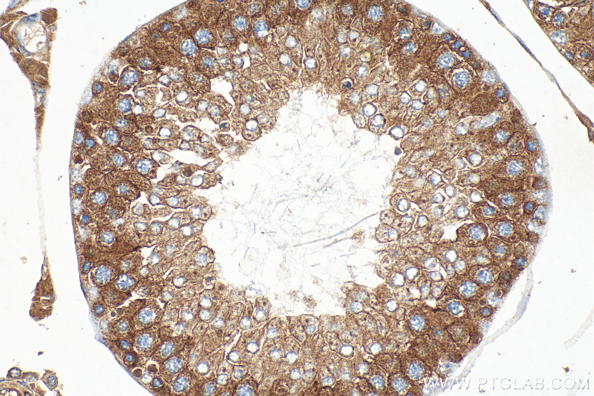 IHC staining of rat testis using 18042-1-AP