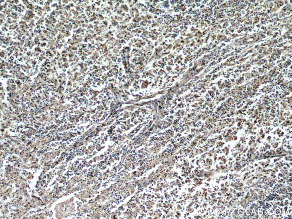 IHC staining of human spleen using 22071-1-AP