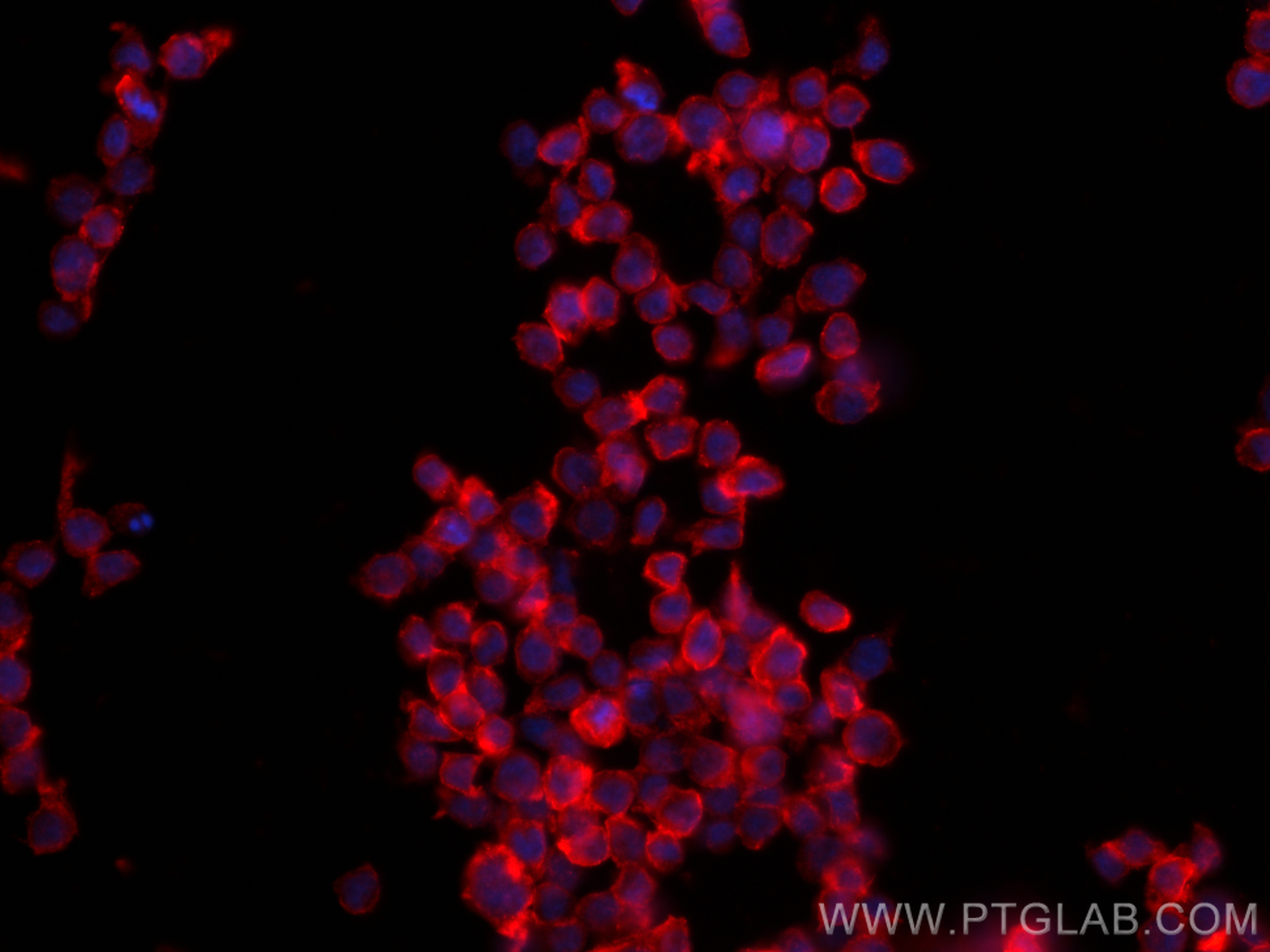 IF Staining of THP-1 using 30420-1-AP