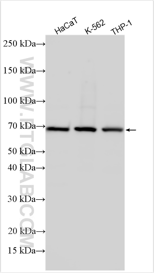 WB analysis using 30420-1-AP