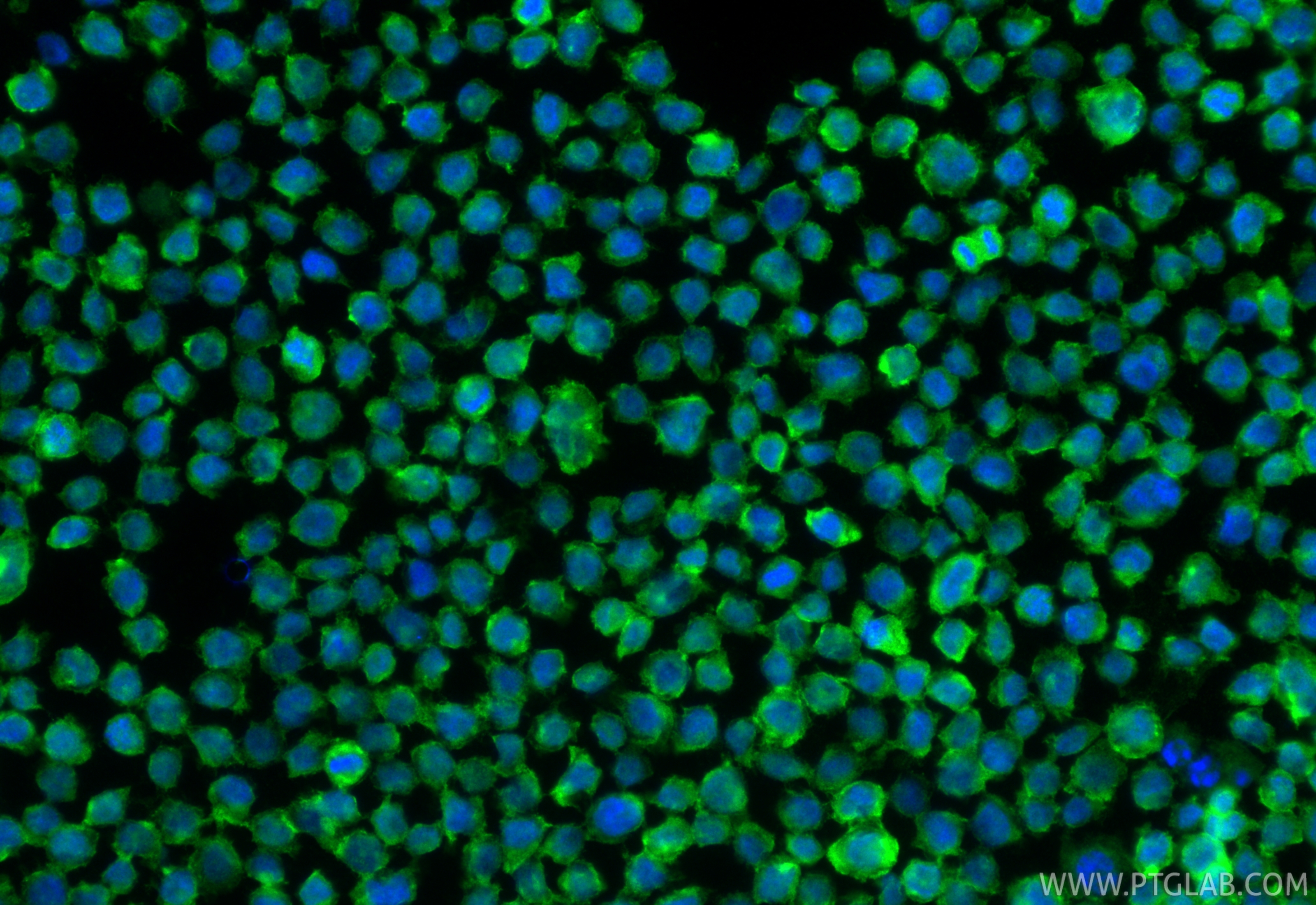 IF Staining of THP-1 using 16153-1-AP IF Staining of THP-1 using 16153-1-AP