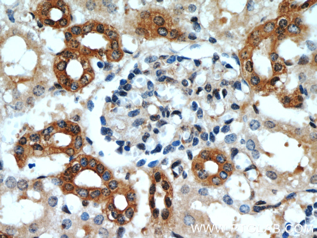 IHC staining of human kidney using 16153-1-AP