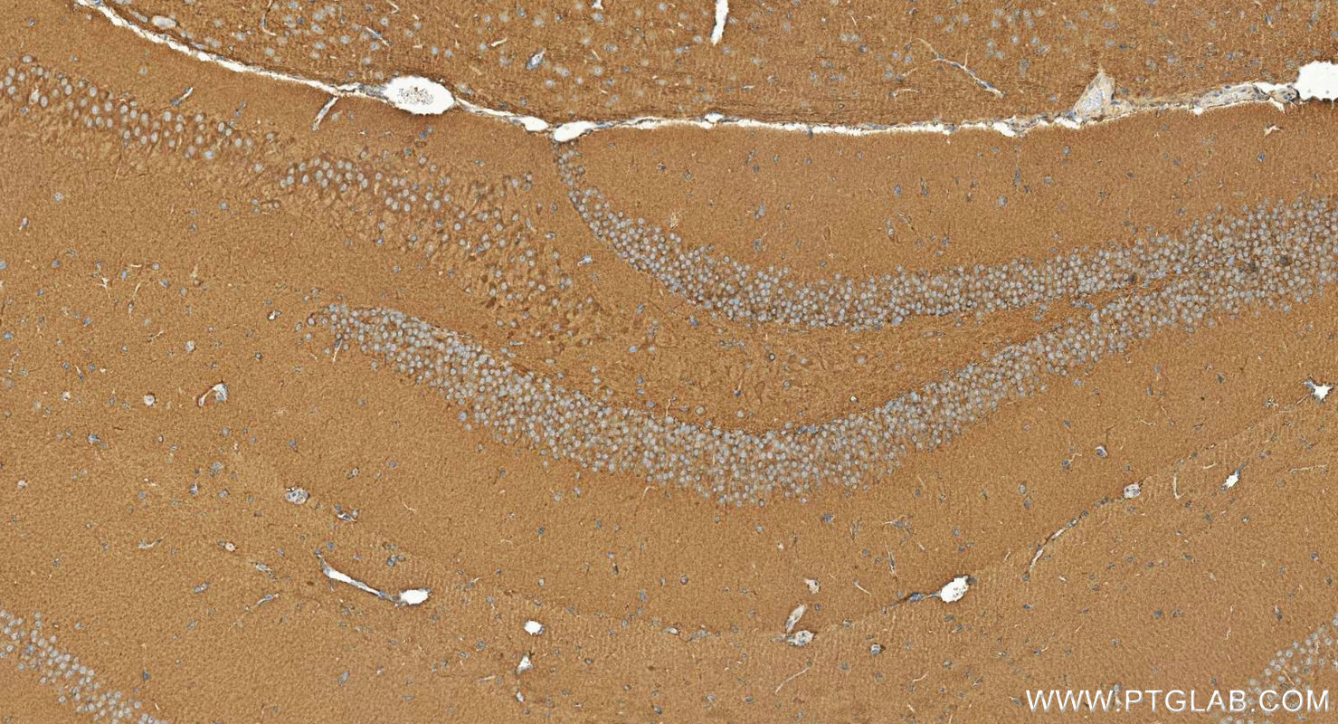 IHC staining of mouse brain using 16153-1-AP IHC staining of mouse brain using 16153-1-AP