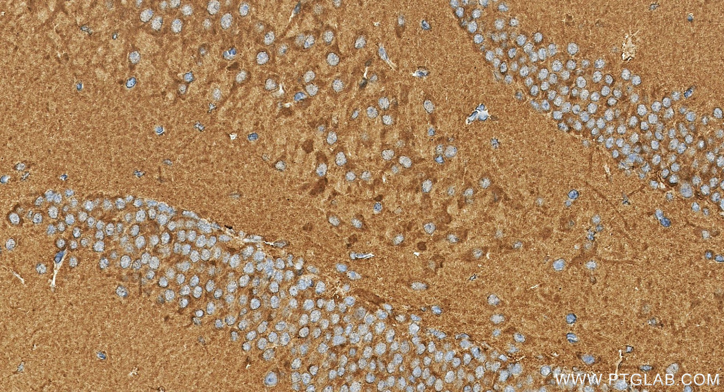 IHC staining of mouse brain using 16153-1-AP IHC staining of mouse brain using 16153-1-AP