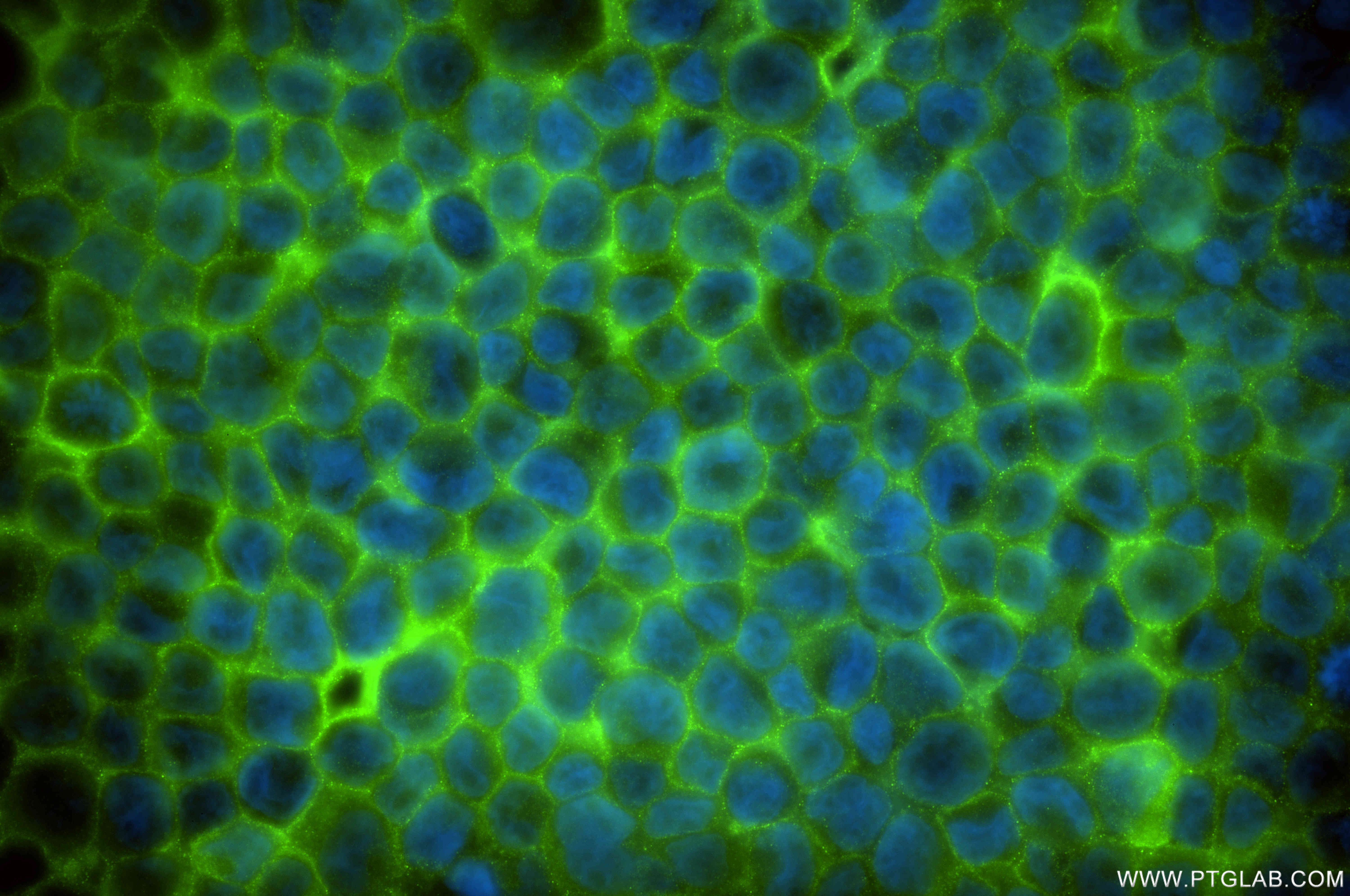 IF Staining of THP-1 using 84911-3-RR