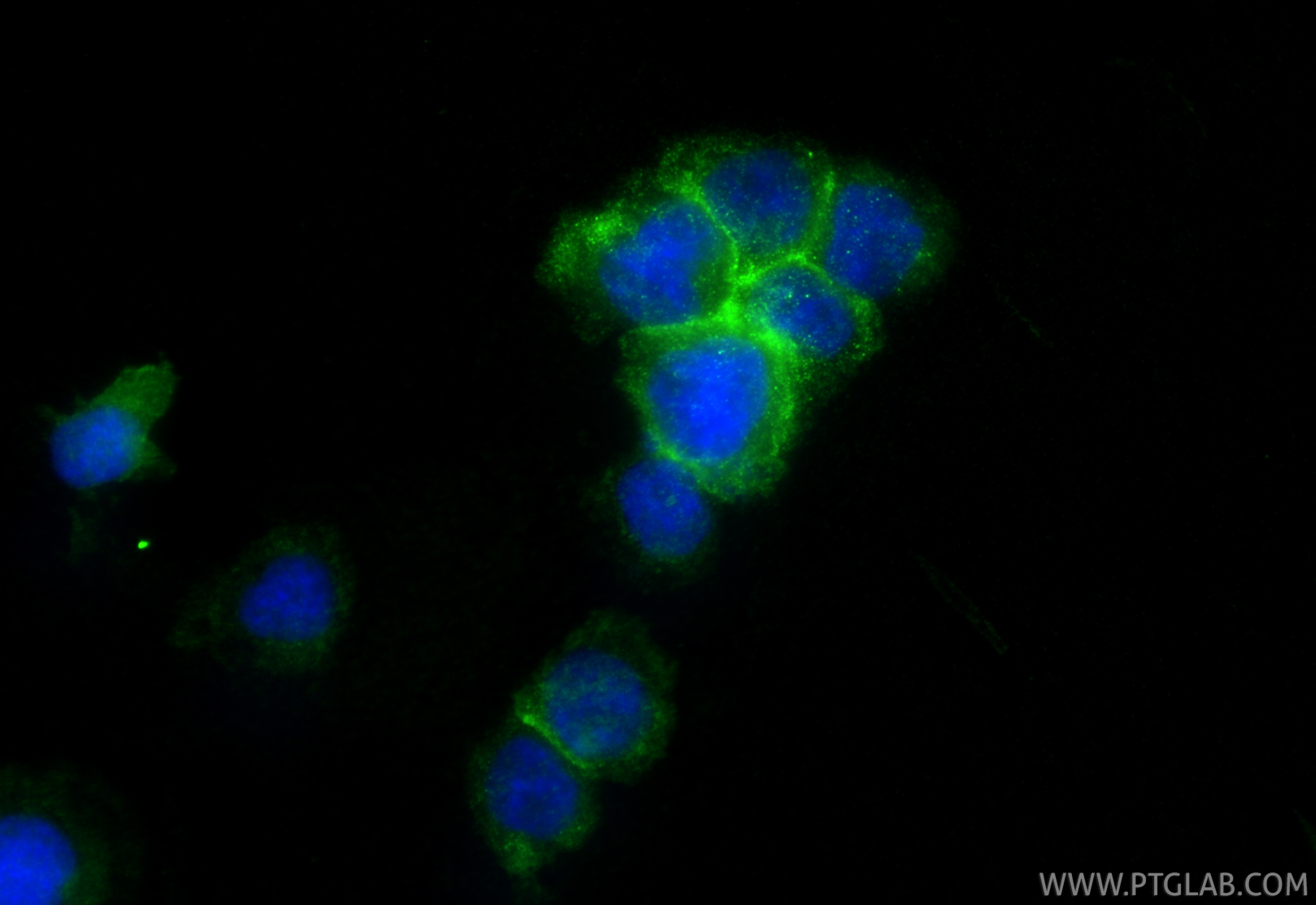 IF Staining of THP-1 using RMX00052 IF Staining of THP-1 using RMX00052