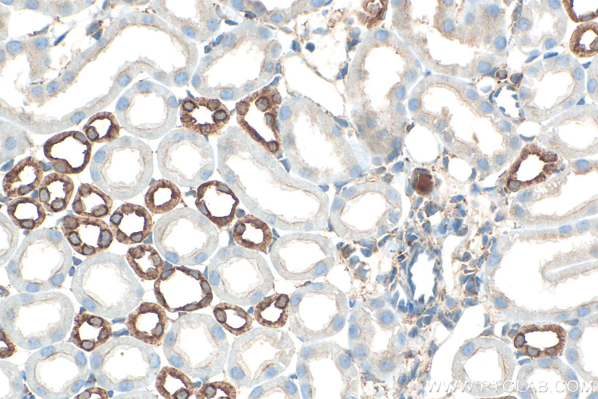 IHC staining of mouse kidney using RMX00052 IHC staining of mouse kidney using RMX00052