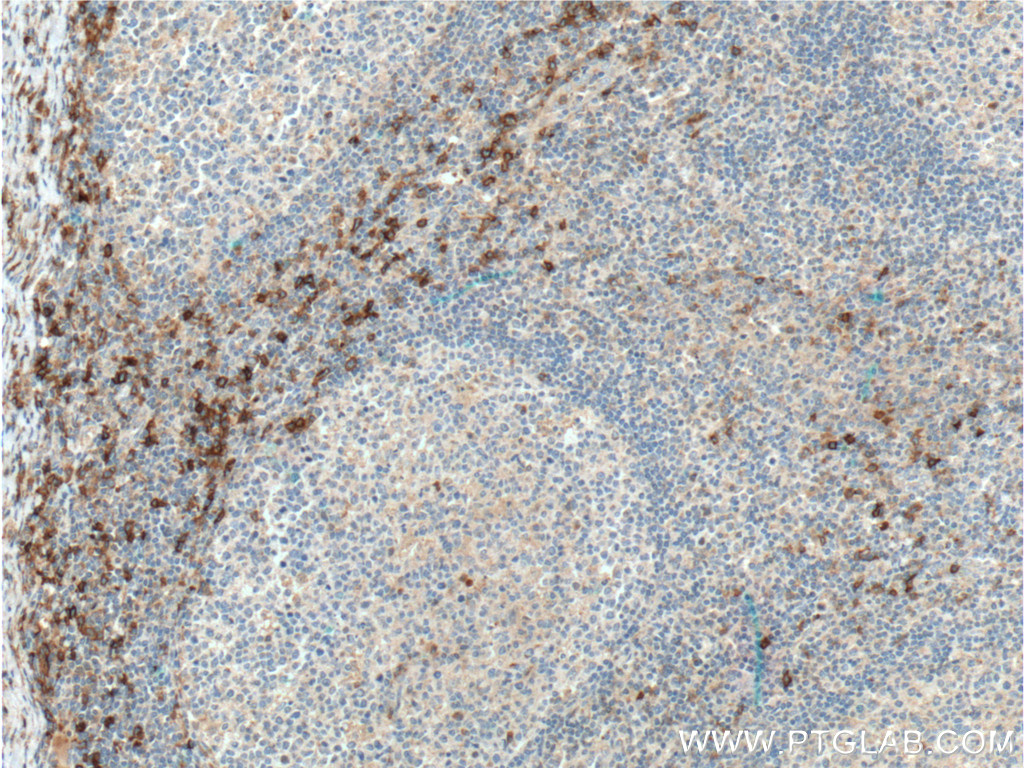 IHC staining of human tonsillitis using 16154-1-AP