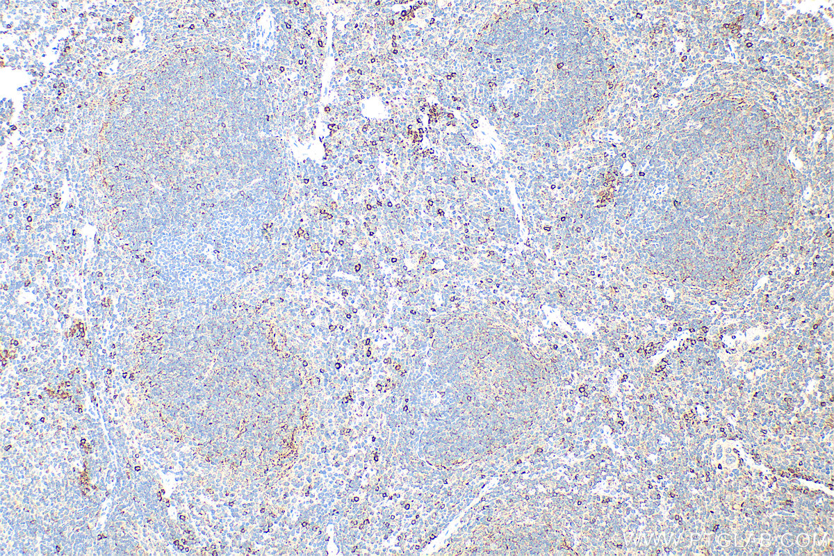 IHC staining of mouse spleen using 16154-1-AP