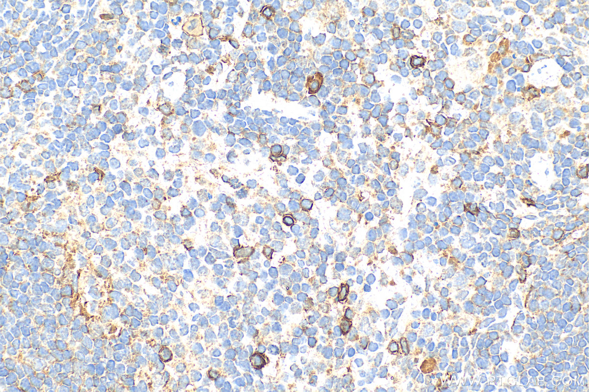 IHC staining of mouse spleen using 16154-1-AP