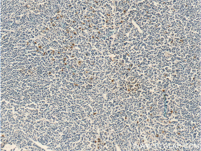 IHC staining of human tonsillitis using 22351-1-AP