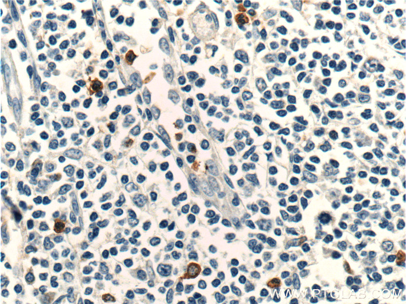 CCR3 Polyclonal antibody