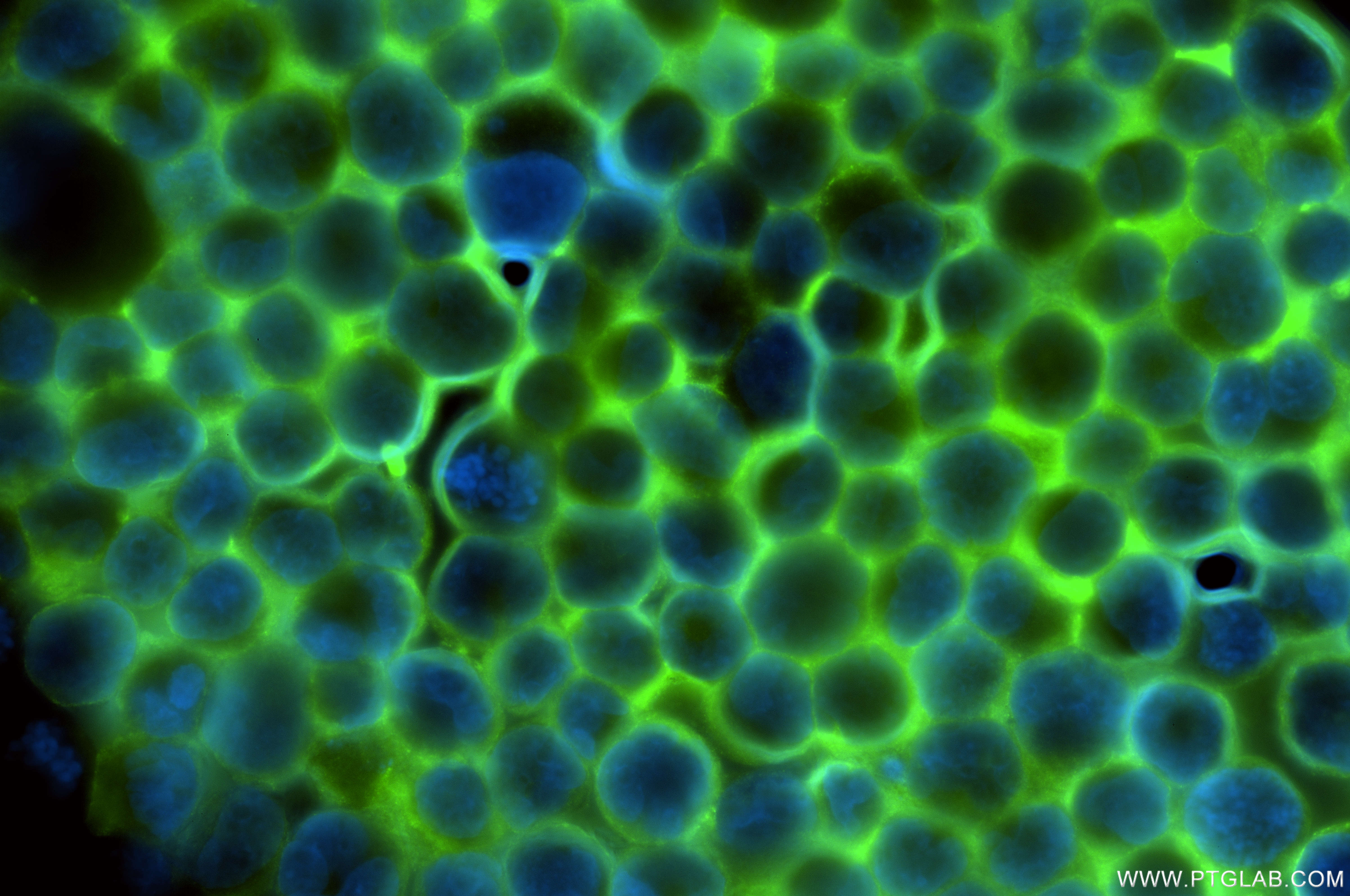 IF Staining of K-562 using 86038-1-RR (same clone as 86038-1-PBS)