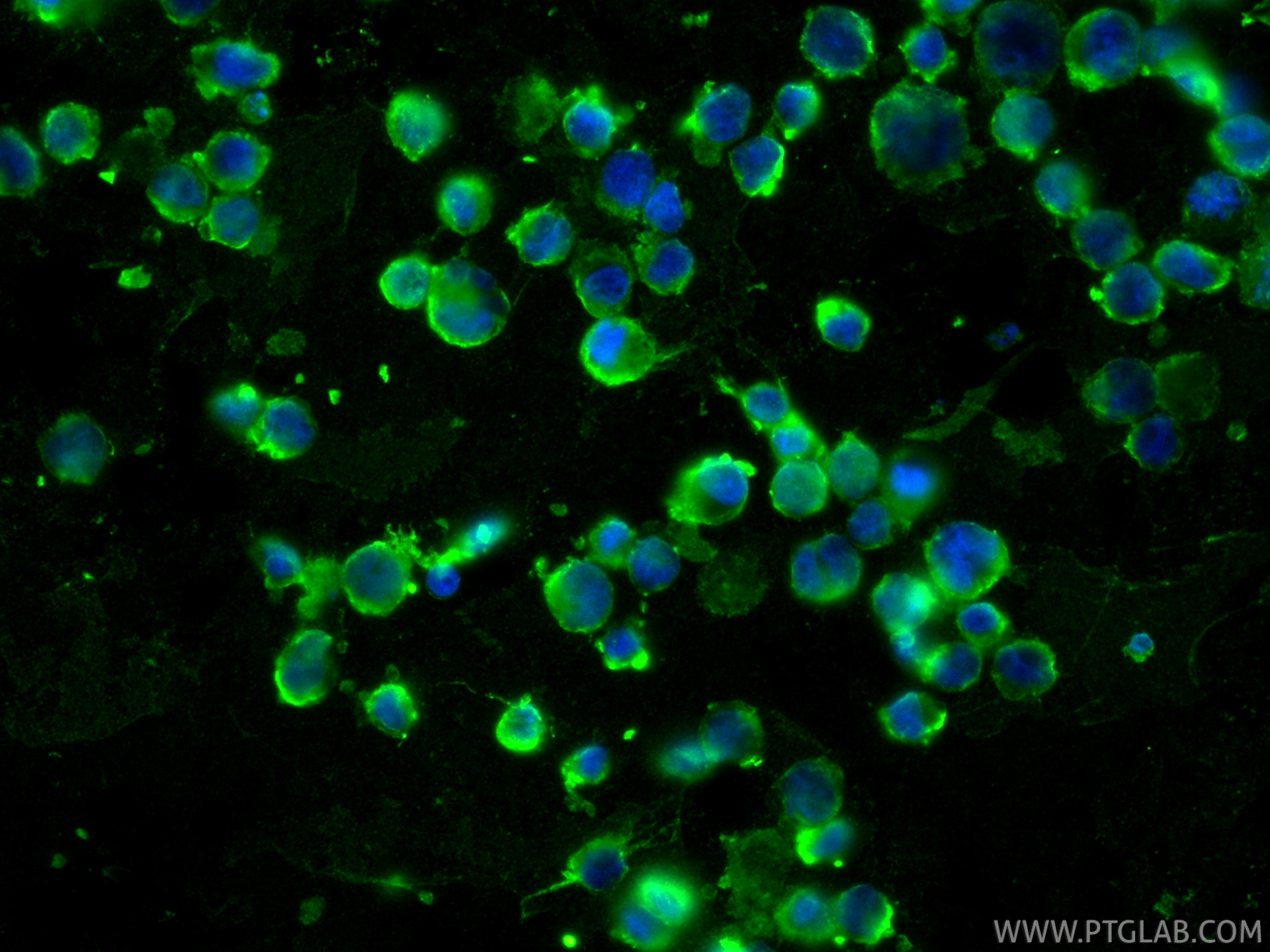 IF Staining of K-562 using 86038-1-RR